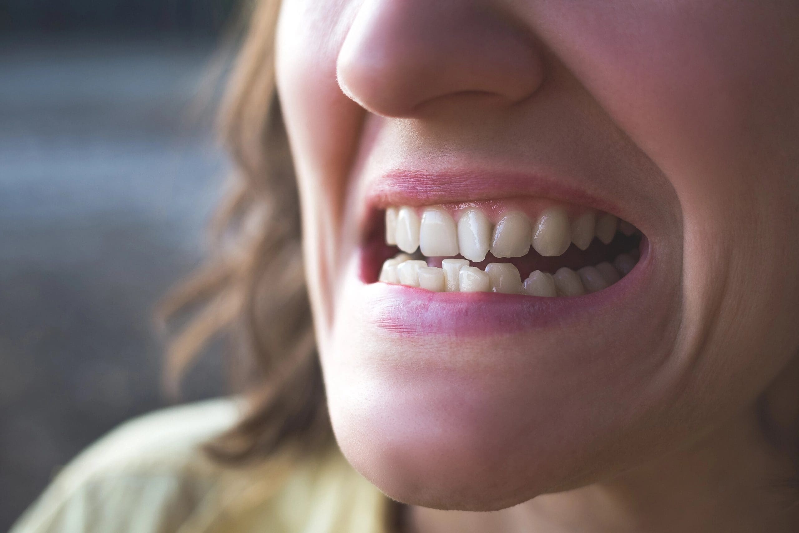 Invisalign for Crooked Teeth: Get Straight Teeth