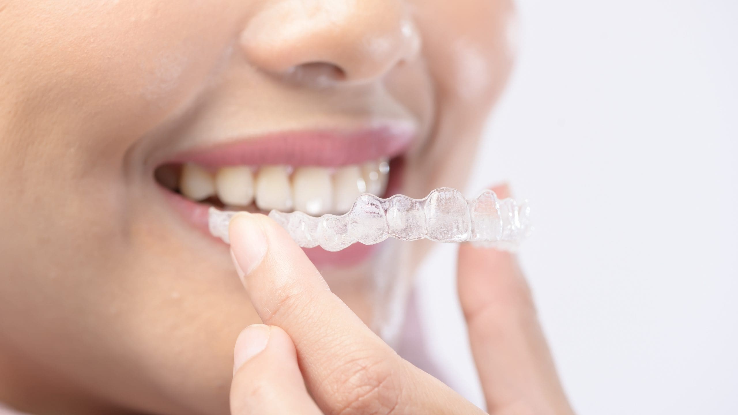 Invisalign for Adults: Achieve a Straighter Smile